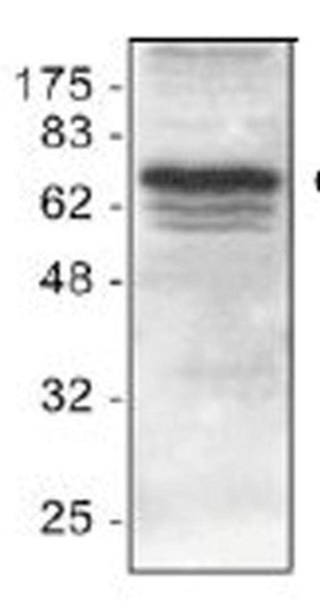 cIAP1 Antibody in Western Blot (WB)