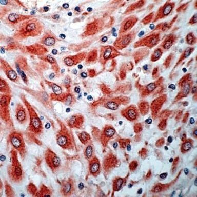 VEGF Receptor 3 Antibody in Immunohistochemistry (IHC)