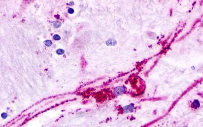 GPR84 Antibody in Immunohistochemistry (Paraffin) (IHC (P))