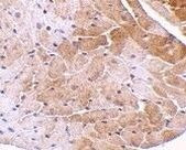 CIDEA Antibody in Immunohistochemistry (Paraffin) (IHC (P))