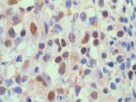 NFkB p65 Antibody in Immunohistochemistry (Paraffin) (IHC (P))