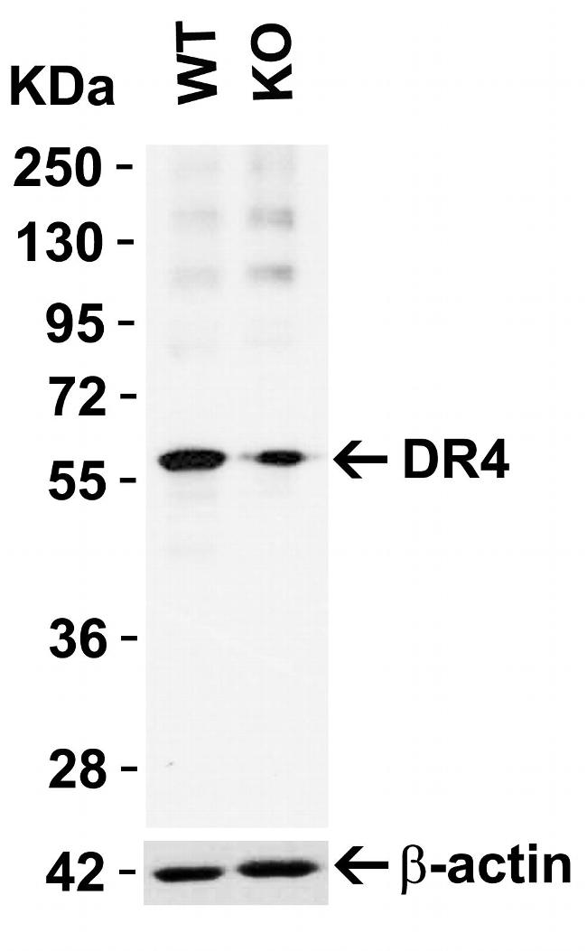 DR4 Antibody in Western Blot (WB)