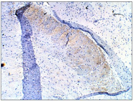 PDE10A Antibody in Immunohistochemistry (Paraffin) (IHC (P))