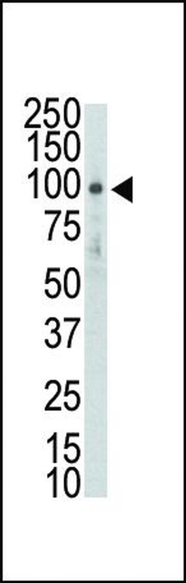 DDR2 Antibody in Western Blot (WB)