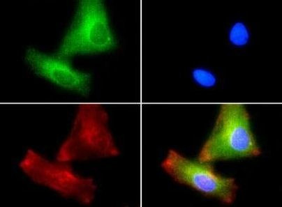 PLTP Antibody in Immunocytochemistry (ICC/IF)