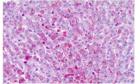 FZD6 Antibody in Immunohistochemistry (Paraffin) (IHC (P))