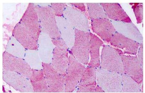 FZD6 Antibody in Immunohistochemistry (Paraffin) (IHC (P))