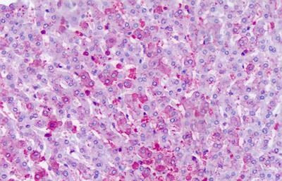 FZD6 Antibody in Immunohistochemistry (Paraffin) (IHC (P))