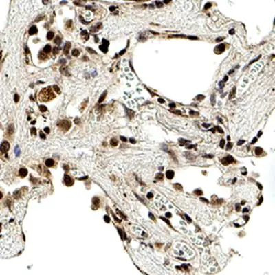 SMAD6 Antibody in Immunohistochemistry (Paraffin) (IHC (P))