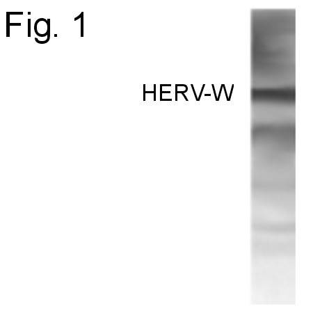 Human Endogenous Retrovirus Antibody in Western Blot (WB)