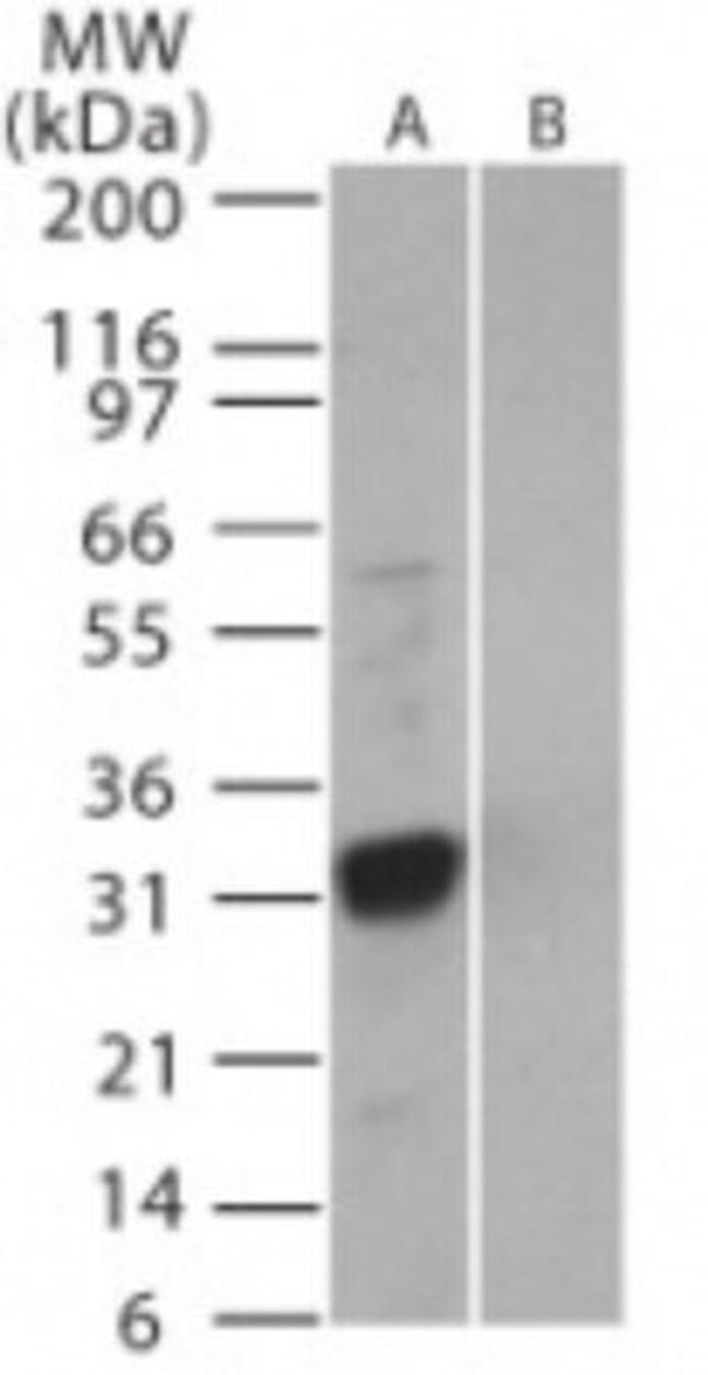 SARS Coronavirus 3b Antibody in Western Blot (WB)