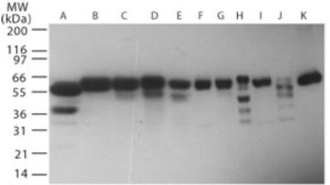 RNF216 Antibody in Western Blot (WB)