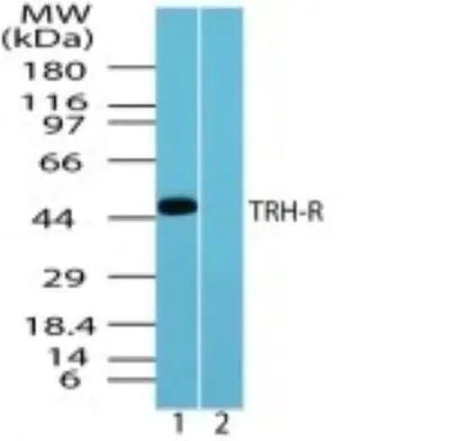 TRHR Antibody in Western Blot (WB)