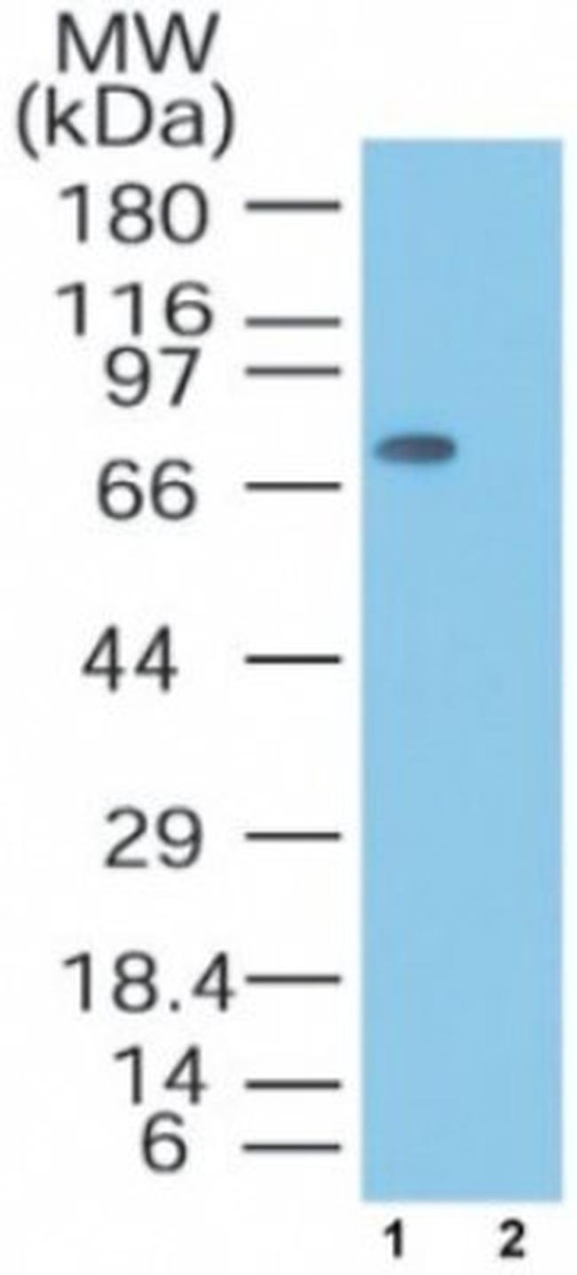 MTA2 Antibody in Western Blot (WB)