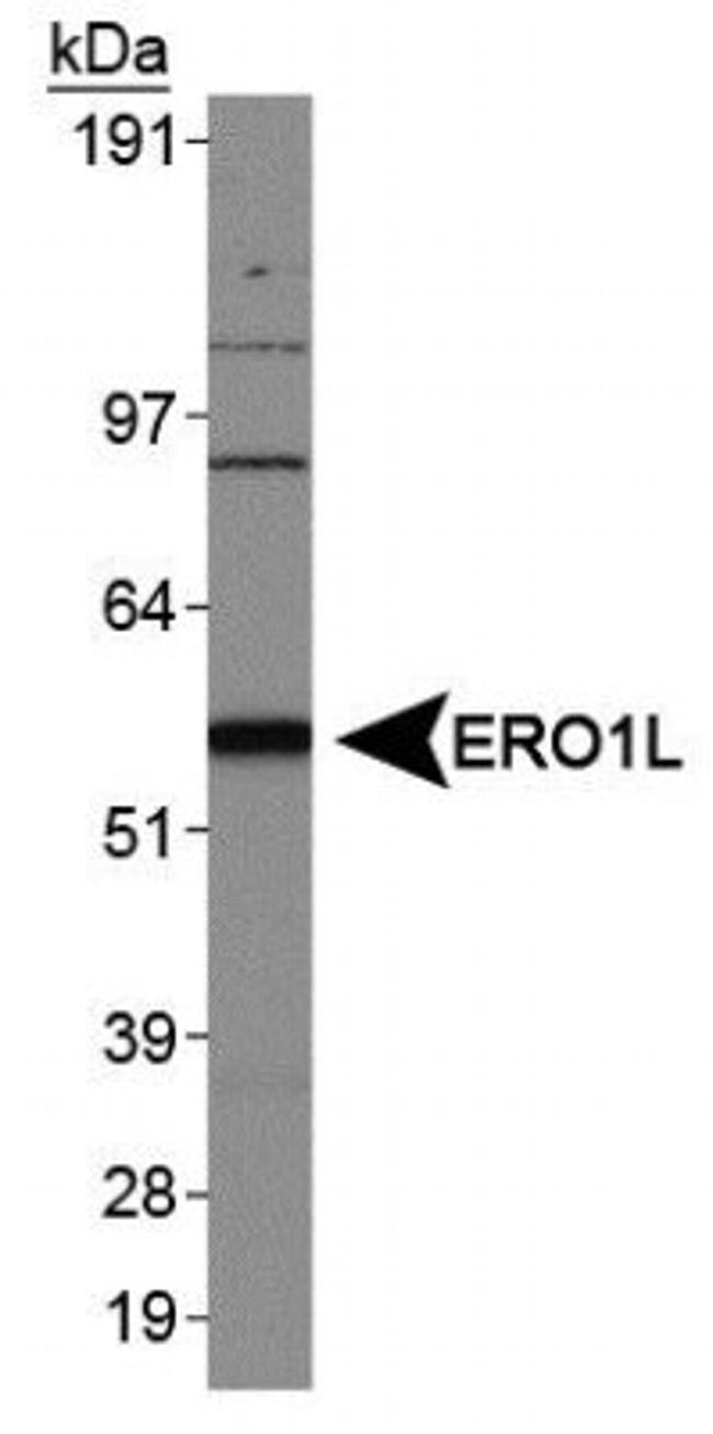 ERO1L Antibody in Western Blot (WB)