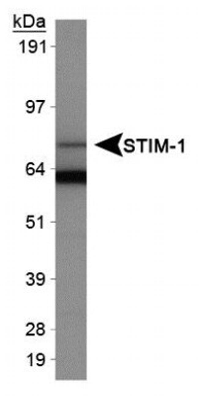 STIM1 Antibody in Western Blot (WB)