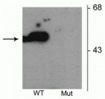 Phospho-Parkin (Ser101) Antibody in Western Blot (WB)