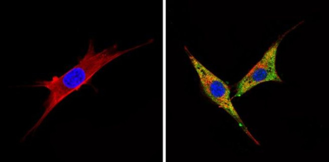 BACE2 Antibody in Immunocytochemistry (ICC/IF)