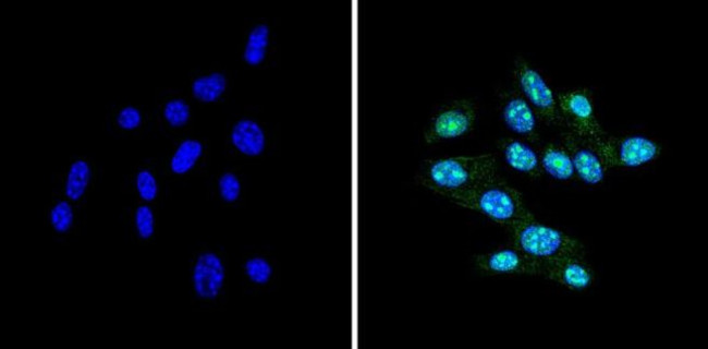 CBP Antibody in Immunocytochemistry (ICC/IF)