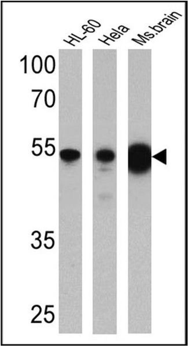 DMAP1 Antibody in Western Blot (WB)