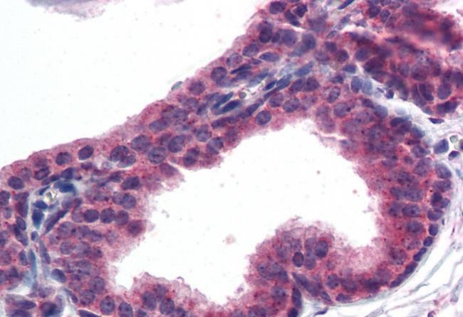 AKT3 Antibody in Immunohistochemistry (Paraffin) (IHC (P))