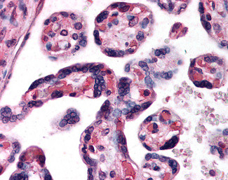 DKK1 Antibody in Immunohistochemistry (Paraffin) (IHC (P))