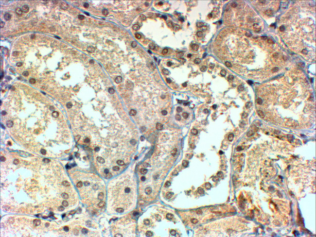 TBL1X/TBL1XR1 Antibody in Immunohistochemistry (Paraffin) (IHC (P))