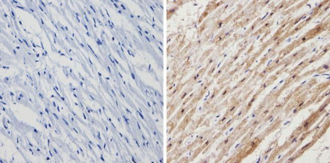 Calsequestrin Antibody in Immunohistochemistry (Paraffin) (IHC (P))