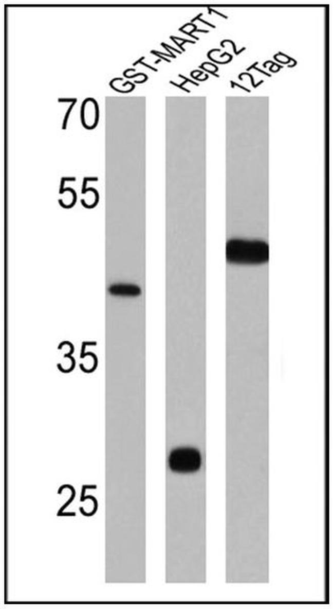 GST Tag Antibody in Western Blot (WB)