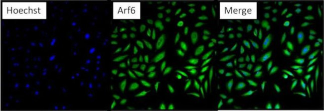 ARF6 Antibody in Immunocytochemistry (ICC/IF)