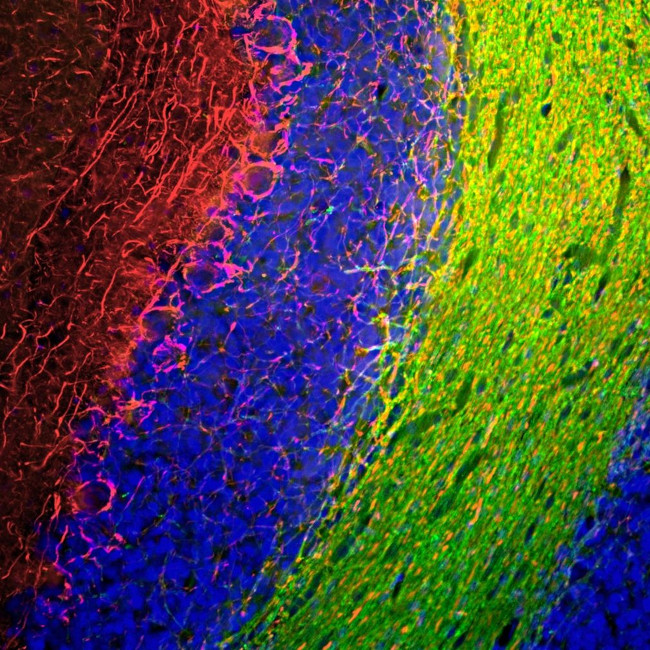 NEFM Antibody in Immunocytochemistry (ICC/IF)