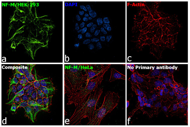 NEFM Antibody