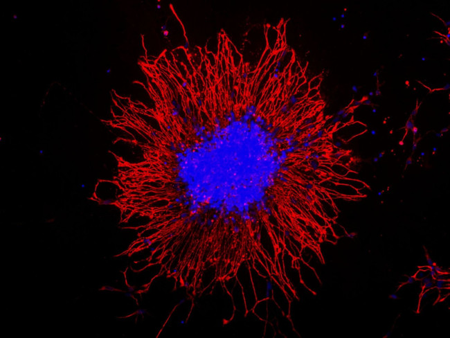 Vimentin Antibody in Immunocytochemistry (ICC/IF)