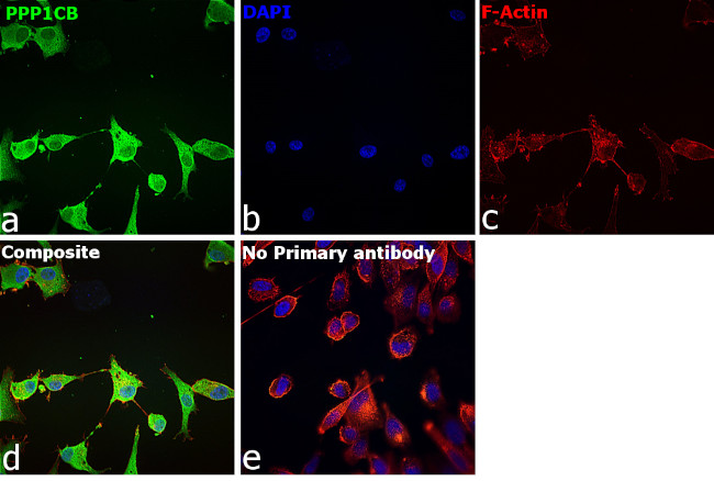 PP1 beta Antibody in Immunocytochemistry (ICC/IF)