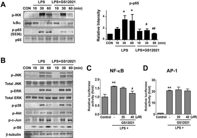 beta Tubulin Antibody in Western Blot (WB)