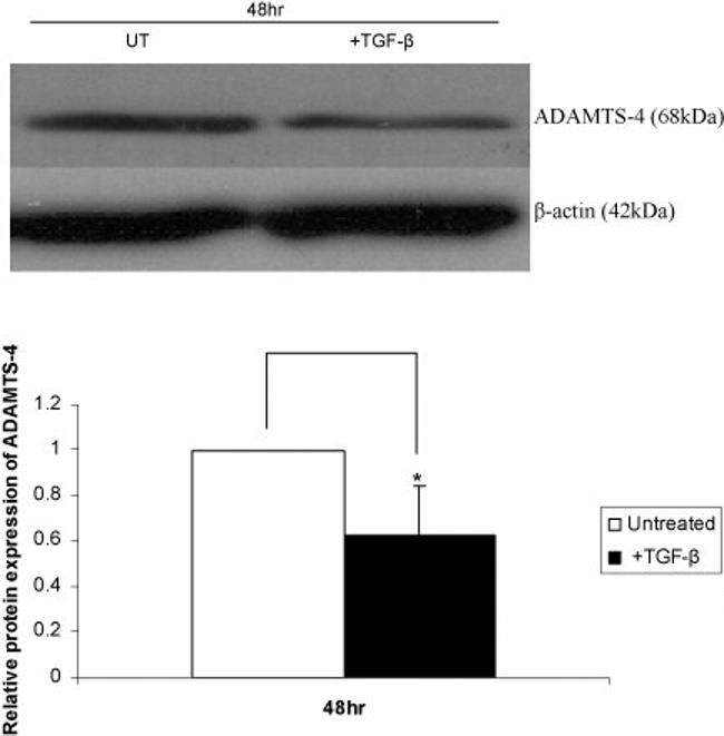 ADAMTS4 Antibody in Western Blot (WB)