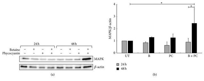 beta Actin Antibody in Western Blot (WB)