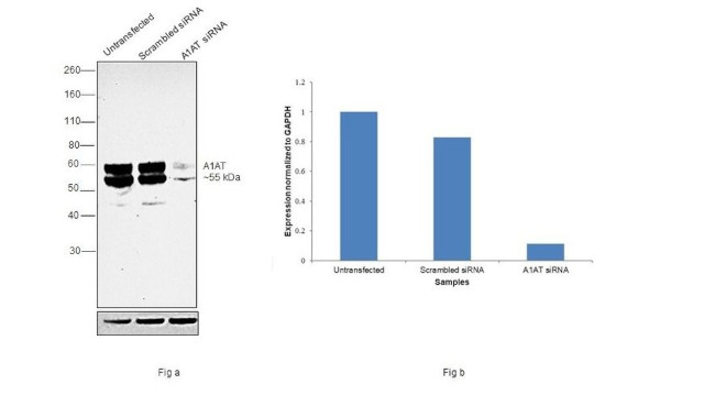 alpha-1 Antitrypsin Antibody