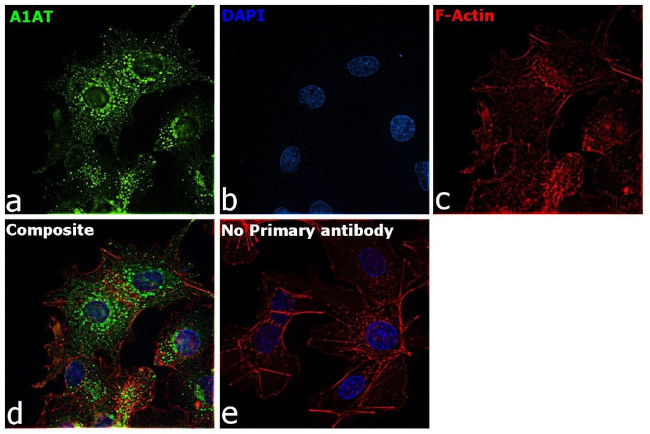 alpha-1 Antitrypsin Antibody in Immunocytochemistry (ICC/IF)