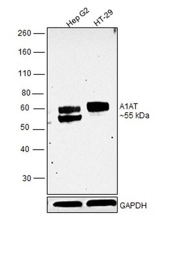 alpha-1 Antitrypsin Antibody in Western Blot (WB)