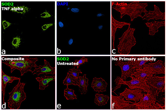 SOD2 Antibody in Immunocytochemistry (ICC/IF)