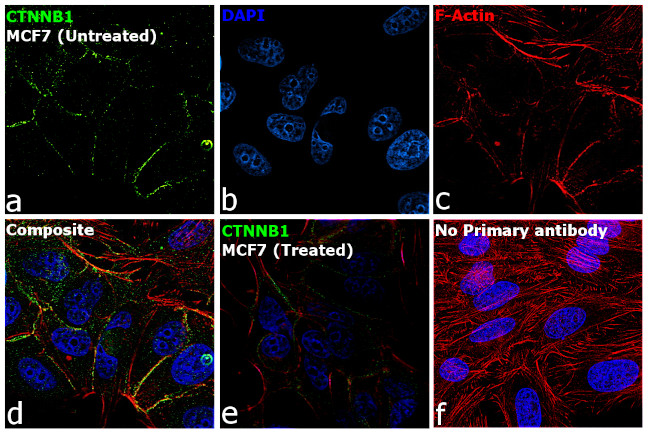 beta Catenin Antibody in Immunocytochemistry (ICC/IF)