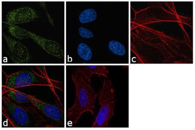 ATG5 Antibody in Immunocytochemistry (ICC/IF)