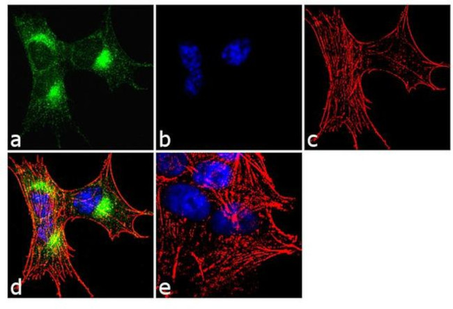 CaMKIV Antibody in Immunocytochemistry (ICC/IF)