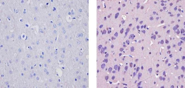 CaMKIV Antibody in Immunohistochemistry (Paraffin) (IHC (P))