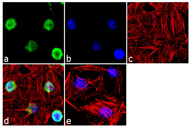 FOXL2 Antibody in Immunocytochemistry (ICC/IF)