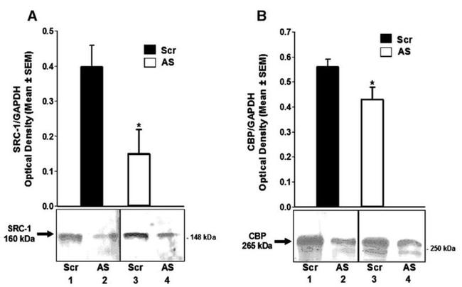 CBP Antibody in Western Blot (WB)