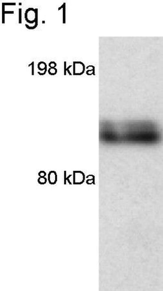 iNOS Antibody in Western Blot (WB)