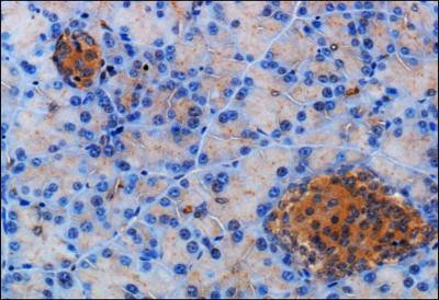 SSTR2 Antibody in Immunohistochemistry (Paraffin) (IHC (P))