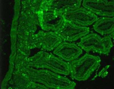 SSTR2 Antibody in Immunohistochemistry (Paraffin) (IHC (P))